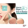 392-Acne Solution